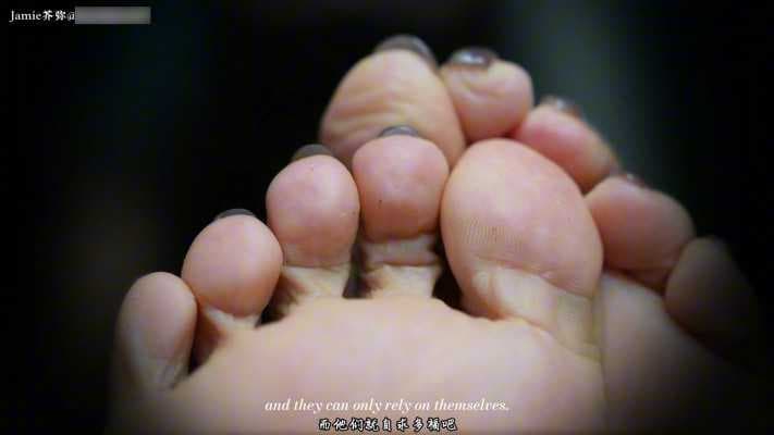 GTS特效精品—细菌生命